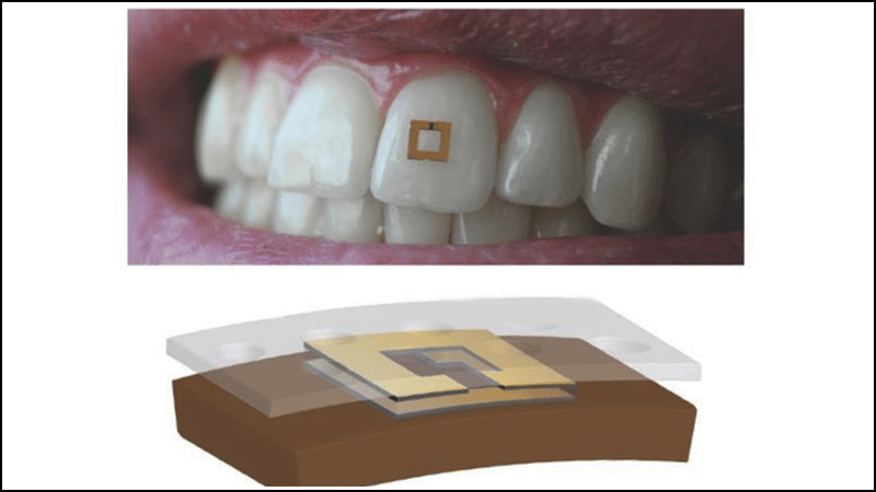 tooth-borne sensor cortisol